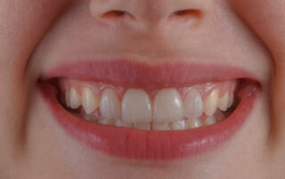 Seguro dental infantil con MyCAXA