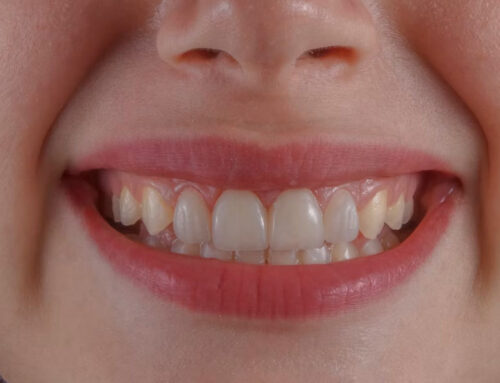 Seguro dental infantil con MyCAXA