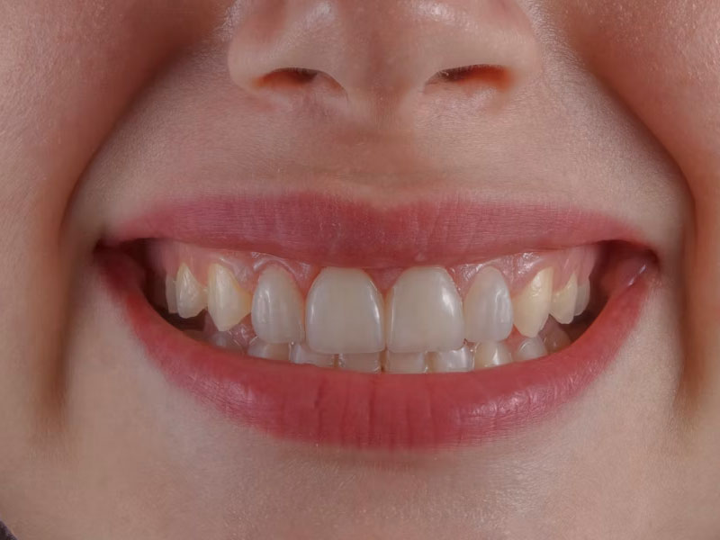 Seguro dental infantil con MyCAXA